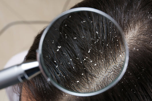 Want a healthy flake-free scalp?
